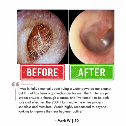 Waxaway™ Electric Ear Wax Removal Kit