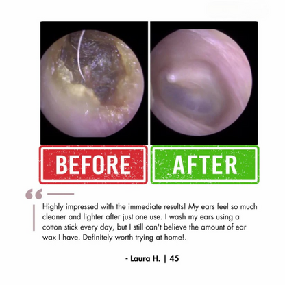 Waxaway™ Electric Ear Wax Removal Kit