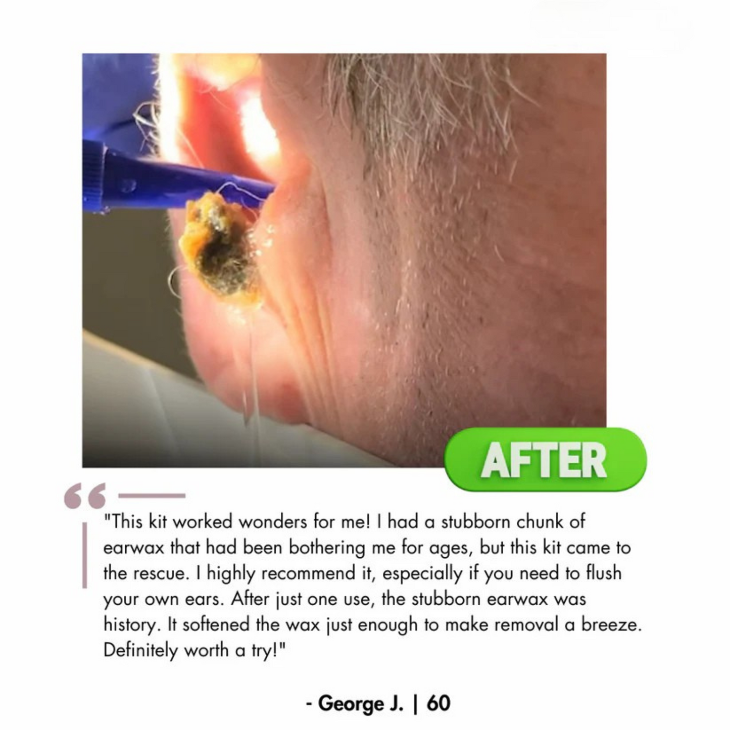 Waxaway™ Electric Ear Wax Removal Kit