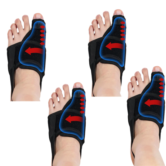 4X Bunion Corrector