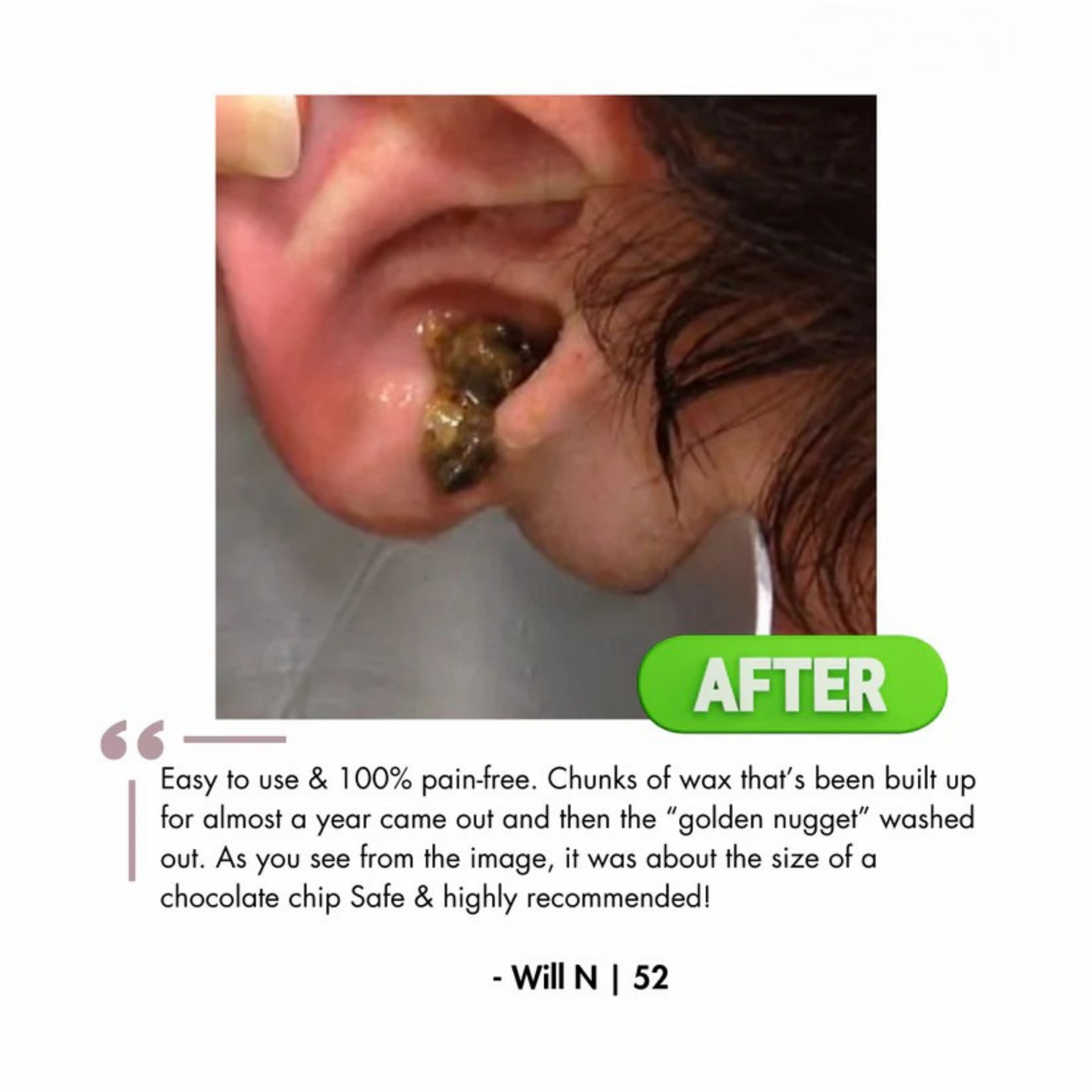 Waxaway™ Electric Ear Wax Removal Kit