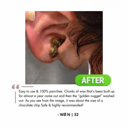 Waxaway™ Electric Ear Wax Removal Kit