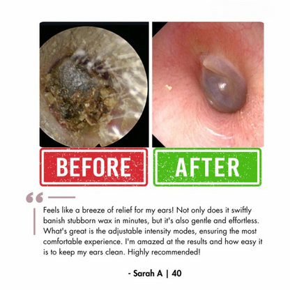 Waxaway™ Electric Ear Wax Removal Kit