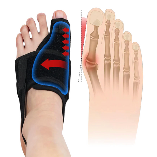 1X Bunion Corrector